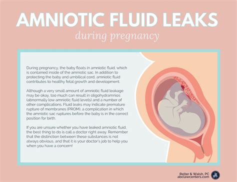 how to tell if leaking amniotic fluid|Signs Of Leaking Amniotic Fluid Vs. Discharge: The Difference